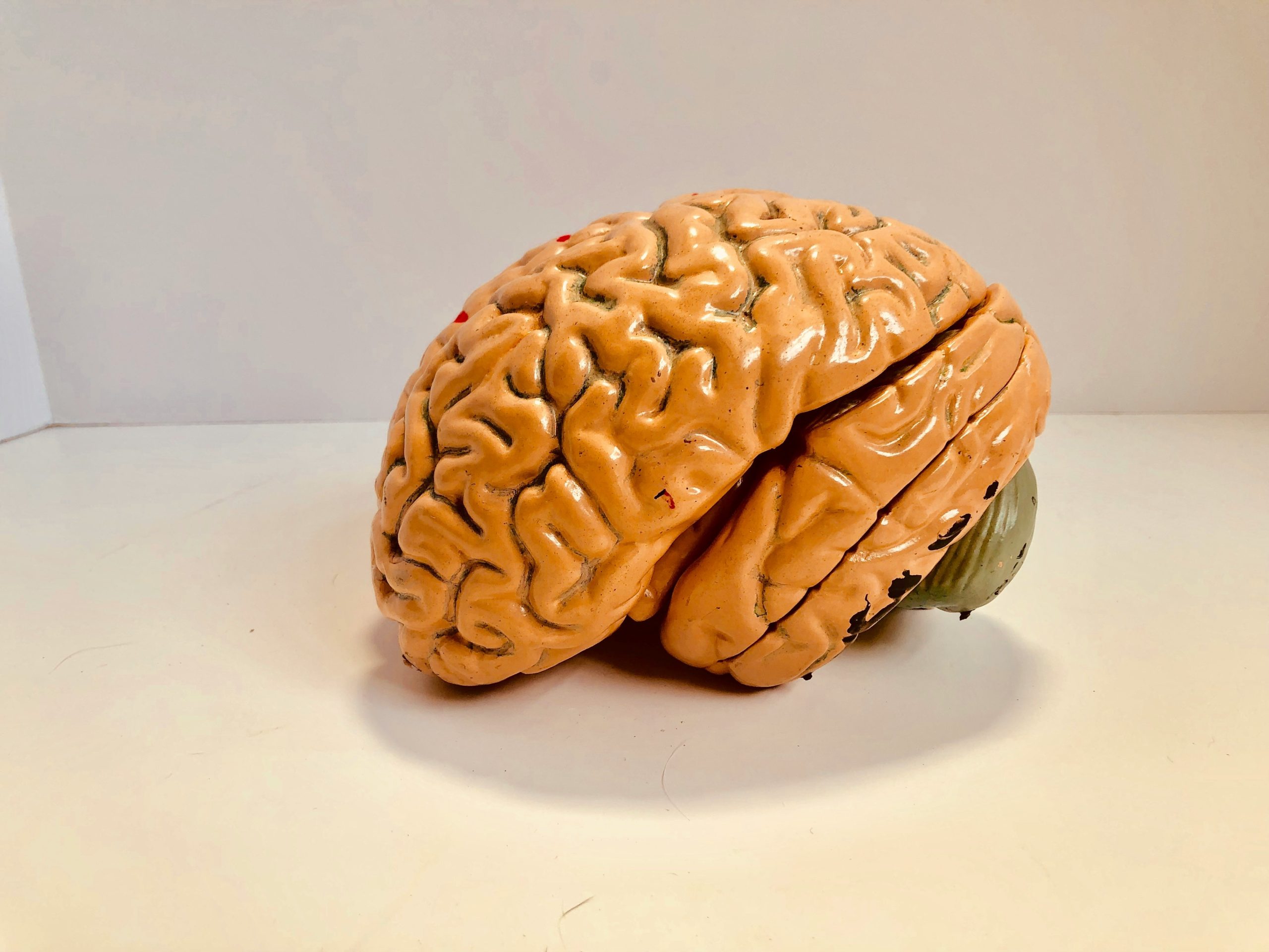Infographic showing how ADHD affects executive function