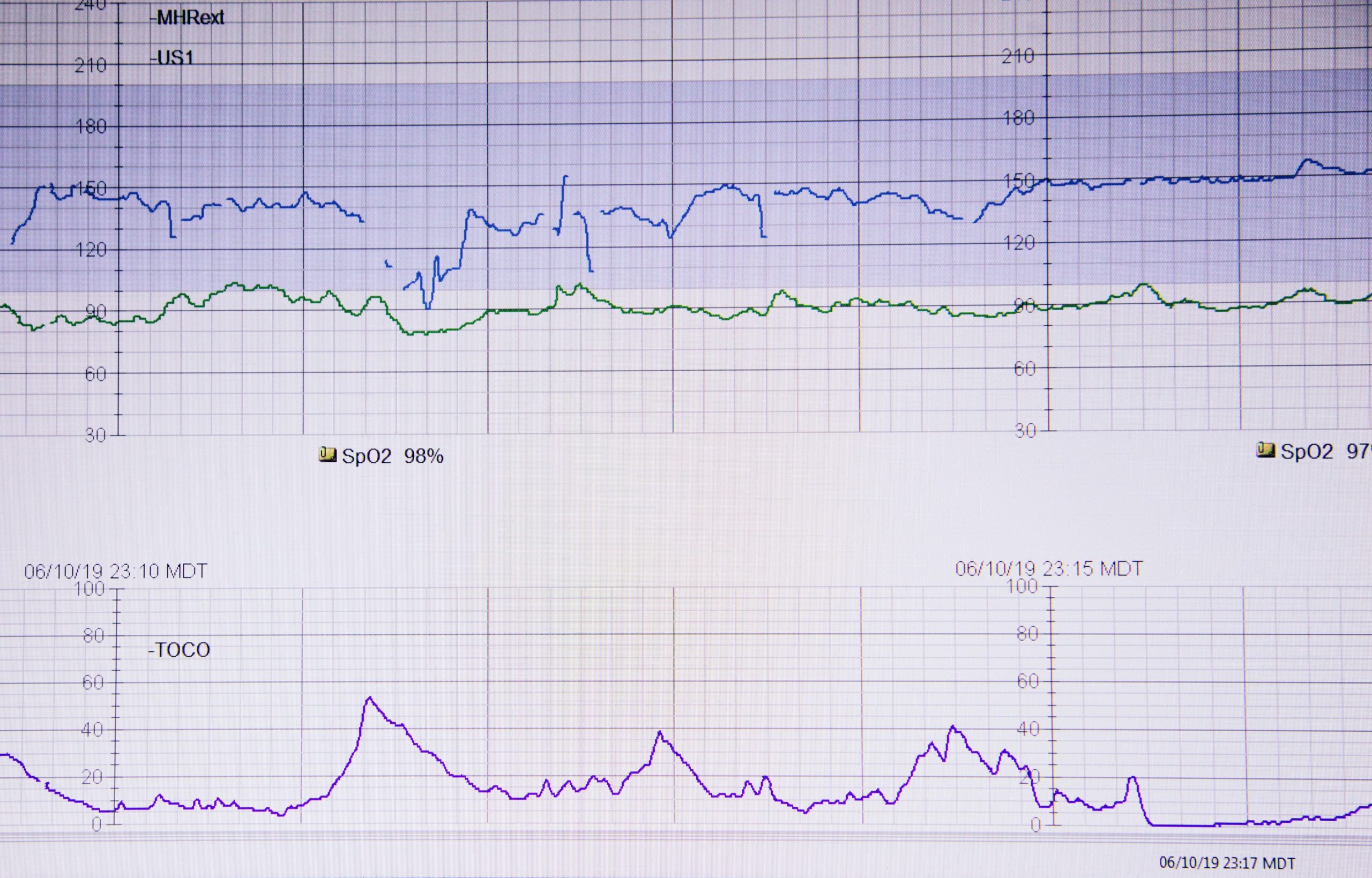 Before and after screenshots of user analytics showing improved productivity metrics